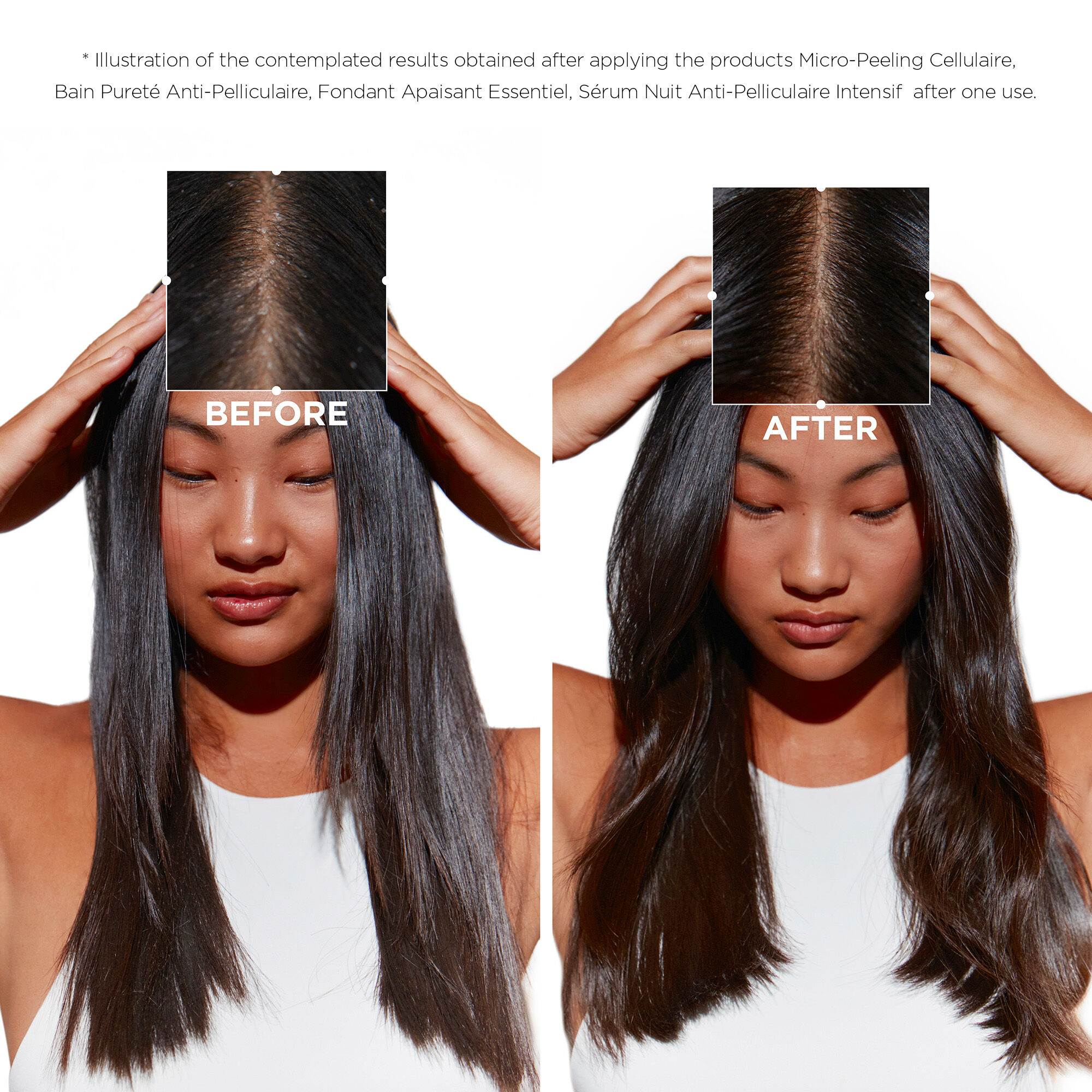 سيمبيوز شامبو منقٍّ ومضاد للقشرة