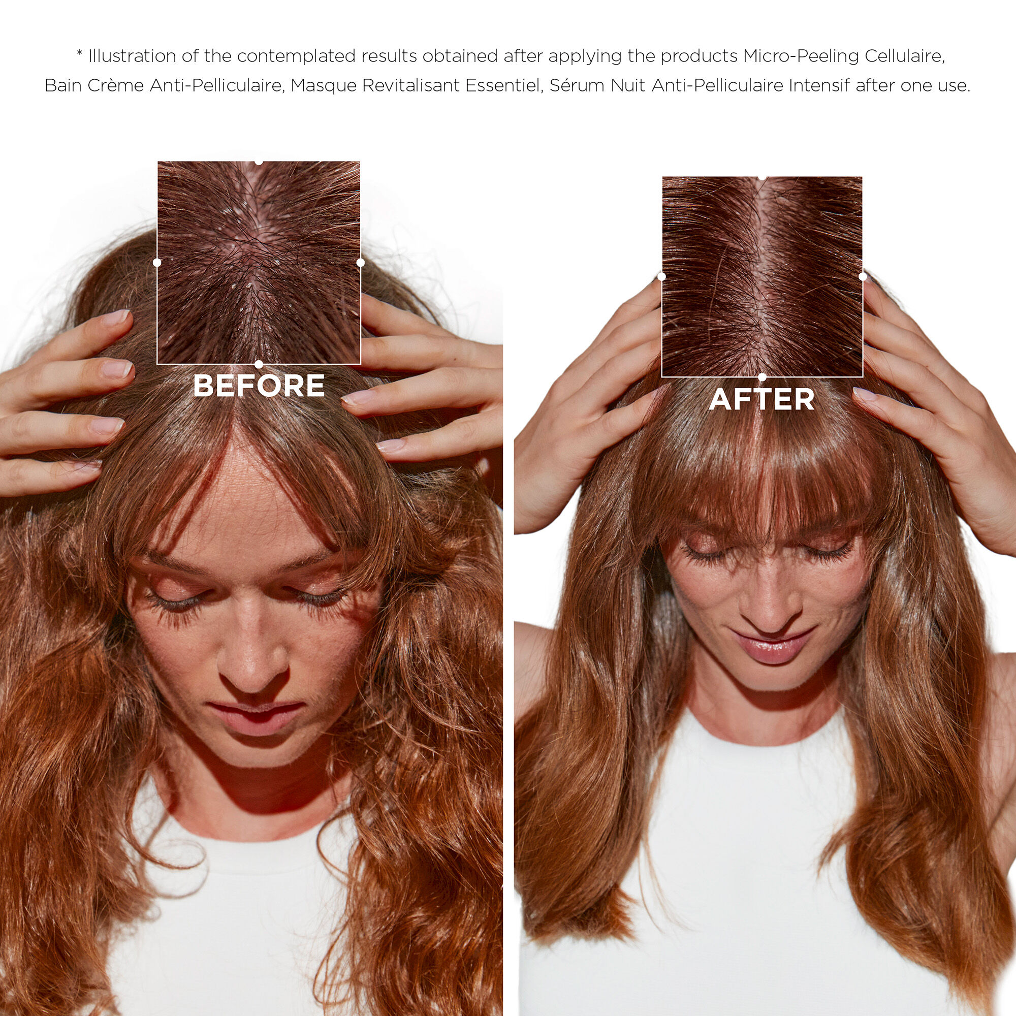 سيمبيوز مايكرو بيلينغ سكرب